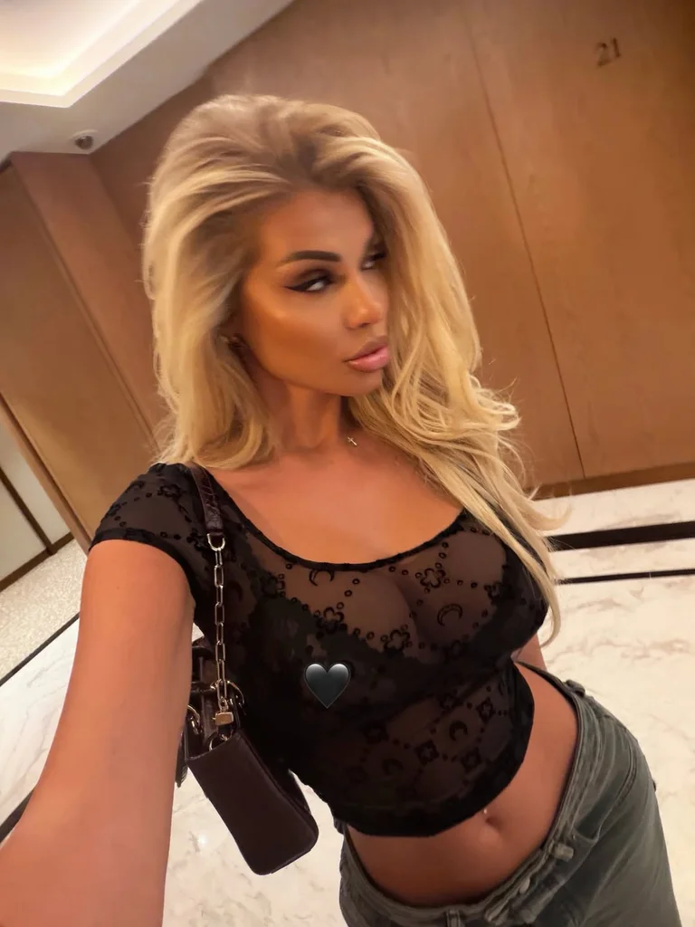 Luana ‘godet’ sërish, shfaqet ‘hot’ në Instagram
