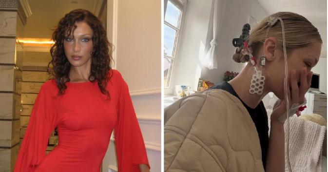 Përkeqësohet gjendja shëndetësore e Bella Hadidit