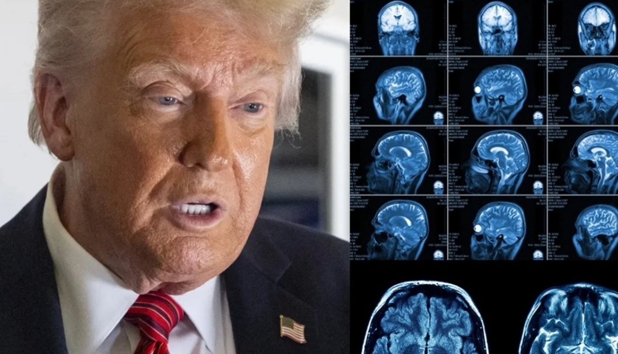Trump i nënshtrohet një skanimi MRI  ngrit pyetje mbi shëndetin e tij