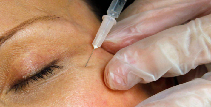 Lëshohen paralajmërime e fundit për rreziqet e fillerëve të fytyrës