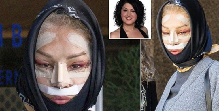 Nadia Almada: Transformimi i jashtëzakonshëm pas ndërhyrjeve estetike në Turqi 