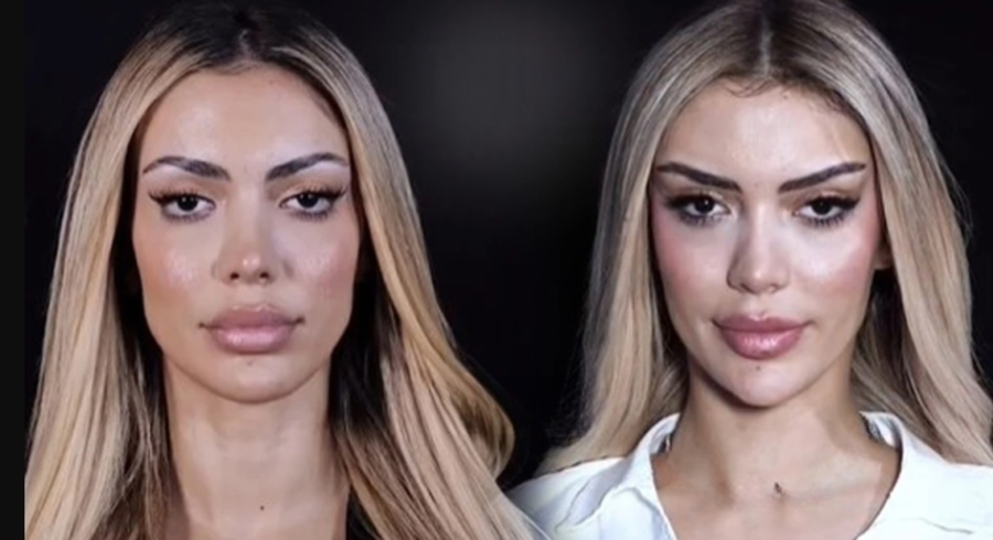 I publikuan fotot e ndërhyrjeve estetike kur ishte në Big Brother  Brikena  Tradhti 