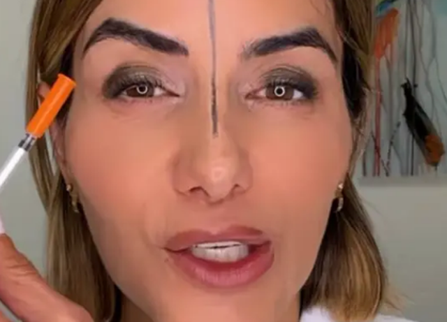 Mjekja injekton botoks vetëm në njërën anë të ballit  rezultati  ÇMEND  rrjetin