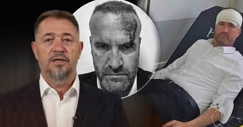 Dy të arrestuar për sulmin ndaj Mehanit në Skenderaj  Lushtaku s i përgjigjet ftesës për intervistim