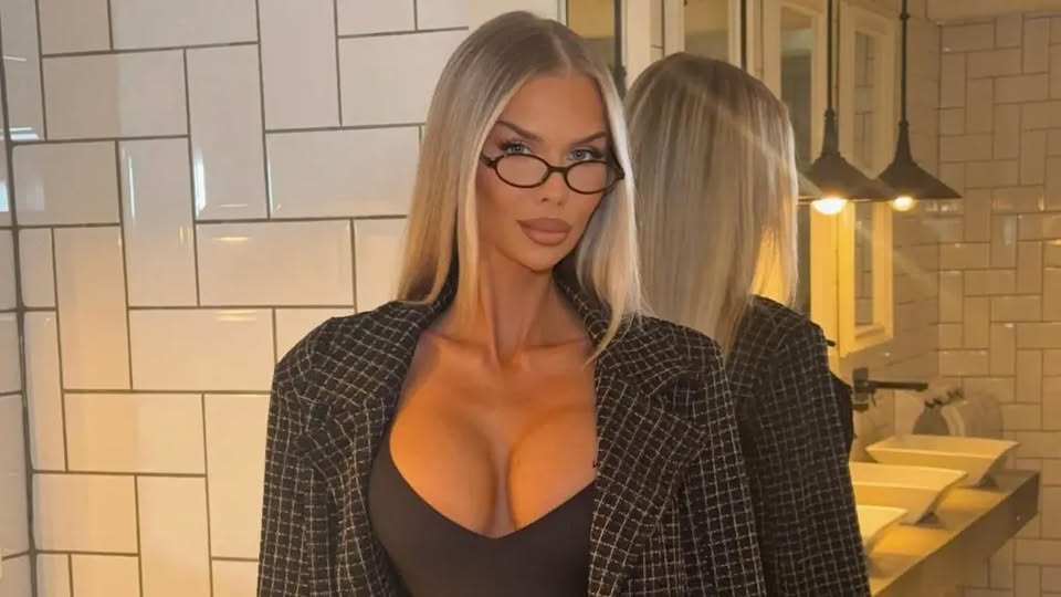 Modelja Lituaneze shkakton sensacion me pamjen e re: "Çfarë ka ndryshuar?" 