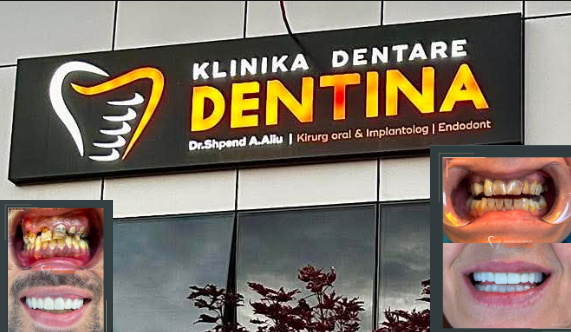 Klinika Dentare Dentina: 20+ vite inovacion që ndryshojnë buzëqeshjet në Kosovë 