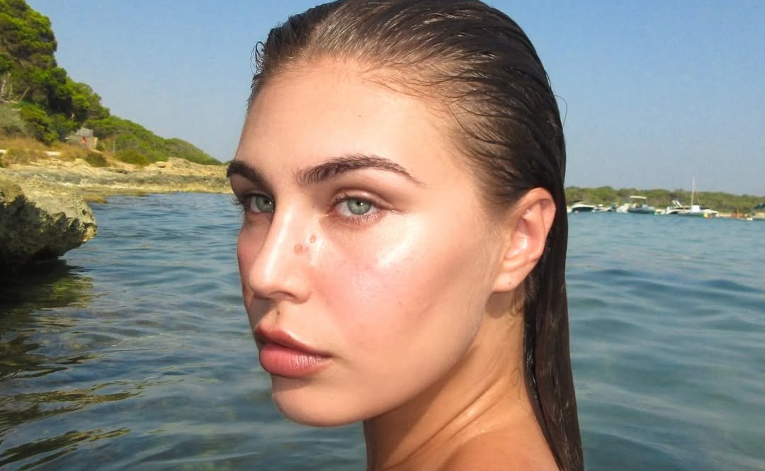 Modelja shqiptare sëmuret gjatë pushimeve  shfaqet nga spitali