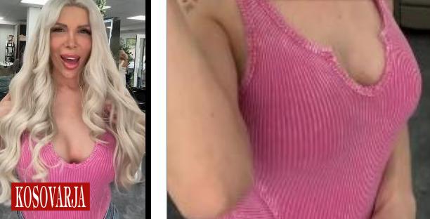 Edona James në këtë gjendje nuk e keni parë kurrë