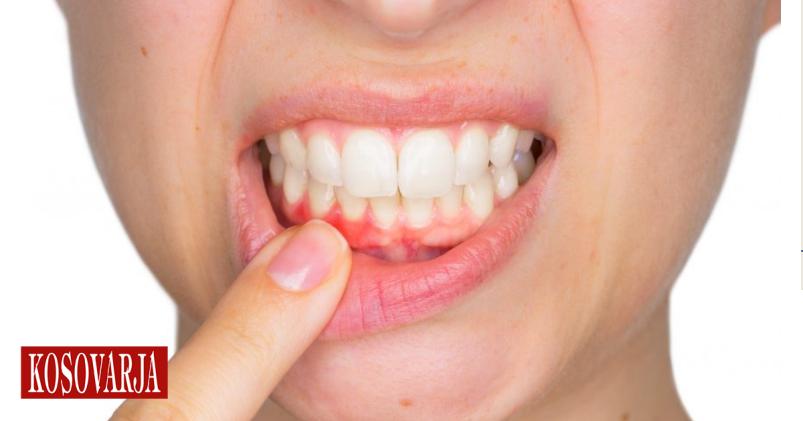 si-te-sheroni-mishrat-e-dhembeve-me-keto-ilace-natyrale